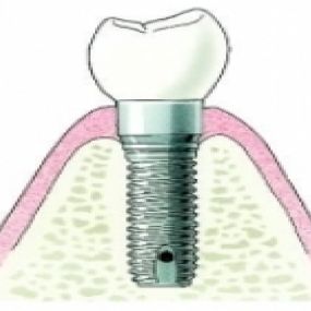 Smile Mondzorg