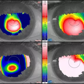 Bild von Contactlenscentrum WFG