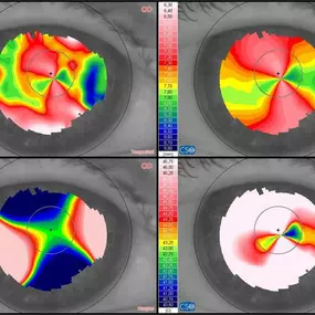 Bild von Contactlenscentrum WFG