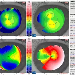 Bild von Contactlenscentrum WFG