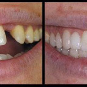 Book now for a healthier smile!