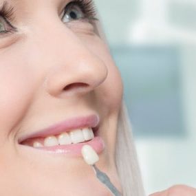 What Dental Veneers Can Do For Your Smile and Self Confidence, Learn more: https://suburbanessexdental.com/what-dental-veneers-could-do-for-your-smile-and-your-self-confidence/