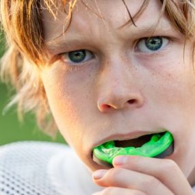 Mouth guards