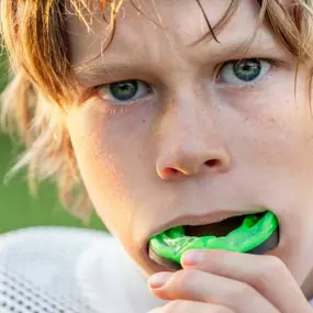 Mouth guards