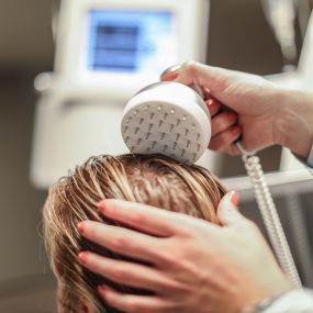 Haarlaser therapie voor je haar