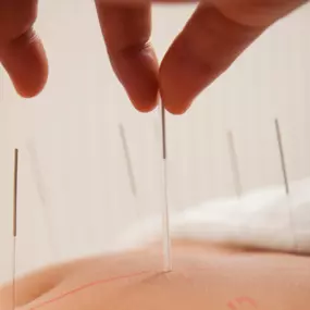 Bild von Jade Clinic of Fertility Acupuncture