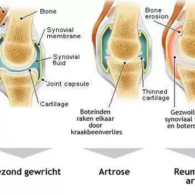 Bild von Pronk Osteopaat DO MRO PRAKTIJK KORSA