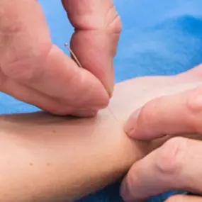 Acupunctuur Franeker