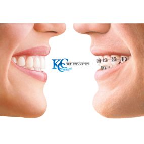 Bild von Katy ClearChoice Orthodontics