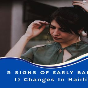 5 Early Signs Of Baldness

1. Changes In Hairline
One of the main early signs of incoming baldness is a change in your hairline. Though it is not a 100% guarantee for baldness, it is still a common sign of it. For the most part, the change in their hairline for men is seen in the receding frontal hairline, specifically the corners. The result of this corner recession usually ends up being what is known as a widow’s peak.