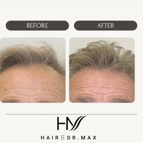 Bild von Hair By Dr. Max, Restoration Center