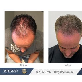 Hair By Dr. Max, Restoration Center