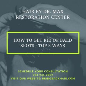 Hair By Dr. Max, Restoration Center

How To Get Rid Of Bald Spots - Top 5 Ways

For many, a bald spot can catch many by surprise, once it becomes very noticeable. It can become a real confidence killer and contribute to one’s insecurities.

Hair loss impacts millions of people every year, with the severity ranging from bald spots to complete balding of the scalp. Like any other type of hair loss, a bald spot can occur from a variety of factors. The majority of bald spot cases are usually due to 