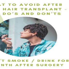 4. Don’t Smoke/Drink For At Least A Month After Surgery
	
Aside from the negatives associated with these activities in general, if you just had your hair transplant surgery done, it is very important that you avoid any smoking or drinking for at least one month. The reason for this is because alcohol might thin your blood and cause bleeding. This in turn does not help you heal, and can even bring complications with it. It is best to avoid alcohol for at least three days after surgery. The same w