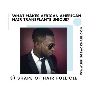 3. Shape of Hair Follicle

Though African American hair is technically less dense than other types of hair, it can appear to be thicker and more dense. This is due to the natural C-shaped curl of each follicle. This can actually serve to be an advantage for the patient when it comes to receiving a hair transplant as less hair from the donor area will be needed to be harvested to obtain a full appearance.