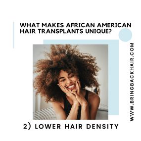 2. Lower Hair Density
Naturally, African American hair has less density than other types of hair. This is why when a FUT Strip procedure is performed, patients have to resort to keeping their hair longer. The leftover scar will usually be very visible as a result. We can erase this negative through the FUE approach. By using smaller punches, such as 0.8mm, we are typically able to mitigate the impact on the scalp. Thus, this will leave less scarring and allow the patient to have more flexibility