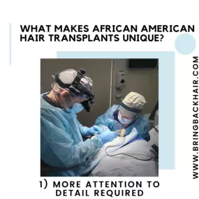 1. More Attention To Detail Required
Using devices such as our Mamba FUE device and Neograft technology can ease the process of hair transplants for African American hair. However, the challenges are still present despite the technology. African American FUE procedures are a bit more challenging than other procedures because the hair restoration surgeon must overcome the natural curl of each hair follicle. However, the advantages of having an FUE procedure are immense as opposed to other approac