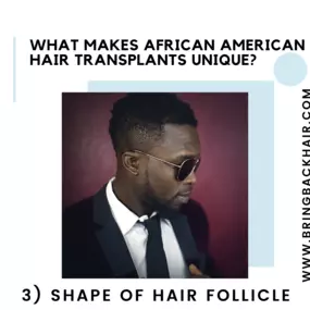 3. Shape of Hair Follicle

Though African American hair is technically less dense than other types of hair, it can appear to be thicker and more dense. This is due to the natural C-shaped curl of each follicle. This can actually serve to be an advantage for the patient when it comes to receiving a hair transplant as less hair from the donor area will be needed to be harvested to obtain a full appearance.