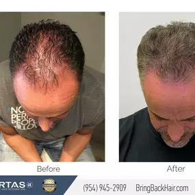 Hair By Dr. Max, Restoration Center