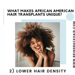 2. Lower Hair Density
Naturally, African American hair has less density than other types of hair. This is why when a FUT Strip procedure is performed, patients have to resort to keeping their hair longer. The leftover scar will usually be very visible as a result. We can erase this negative through the FUE approach. By using smaller punches, such as 0.8mm, we are typically able to mitigate the impact on the scalp. Thus, this will leave less scarring and allow the patient to have more flexibility