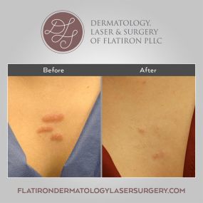 Medical dermatology can improve the appearance of the skin by eliminating blemishes, skin dryness, redness, and discoloration. Laser, surgery, topical, and oral skin treatment options are available to provide optimal skin healing and beautifying results.