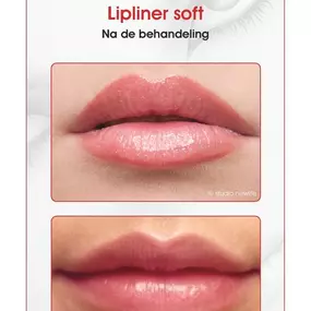 Bild von Newlife Permanente Make-up Studio
