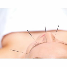 Acupunctuur Coevorden