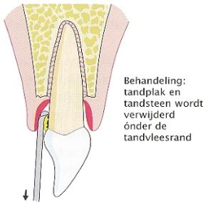 Engweg Mondhygiënistepraktijk