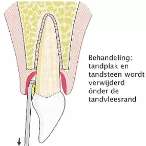 Engweg Mondhygiënistepraktijk