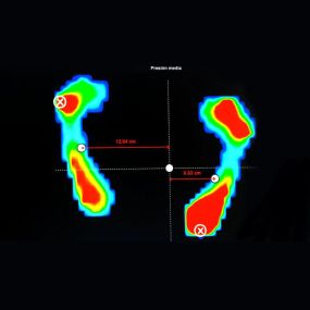 clinica-podologica-jimenez-moreno-estudio-pisada-01.jpg