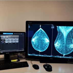 mammographie Dufrane Philippe