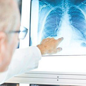 California Lung Associates is a Pulmonologist serving Los Angeles, CA