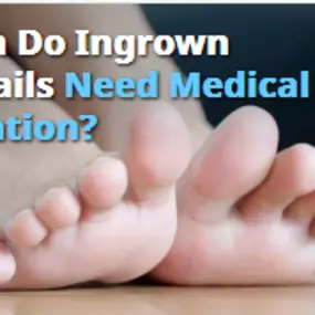 Video: When Do Ingrown Toenails Need Medical Attention (https://vimeo.com/251669833)