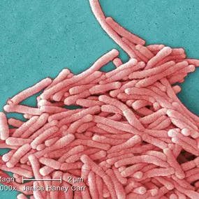 legionella_en_Don_Benito.jpg