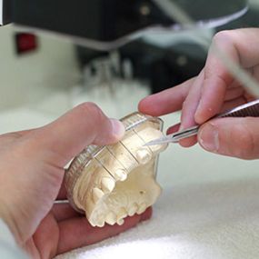 dental-sirera-protesis-01.jpg