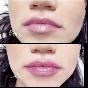 Fresh set of lips for this first timer, timeless. Call for your next appointment here at Modesto Aesthetics and Laser.