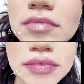 Fresh set of lips for this first timer, timeless. Call for your next appointment here at Modesto Aesthetics and Laser.