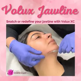 Are you looking to improve the definition of your jawline? Modesto Aesthetics and Laser can help! We use Volux XC,  a member of the Juvéderm Family of Fillers, which was specifically created to improve jawline definition. Redefine your profile or snatch your jawline with this innovative treatment. Trust us to create a treatment plan that fits your goals!