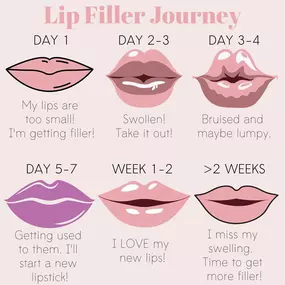 Are you curious about what to expect after your lip filler appointment with Modesto Aesthetics and Laser? Check out this Lip Filler Journey. If you want to enhance your lips, Modesto Aesthetics and Laser is the go-to destination for lip-filler!