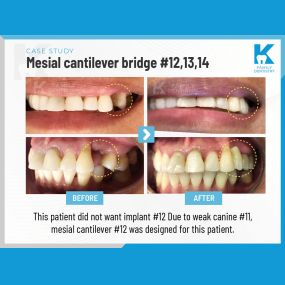 K Family Dentistry - General Cosmetic Emergency Implants Dentist in Pflugerville, TX 78660