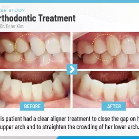 K Family Dentistry - General Cosmetic Emergency Implants Dentist in Pflugerville, TX 78660