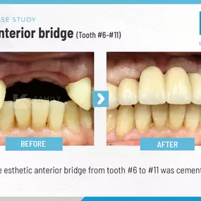 K Family Dentistry - General Cosmetic Emergency Implants Dentist in Pflugerville, TX 78660