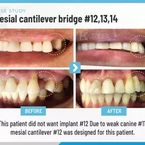 K Family Dentistry - General Cosmetic Emergency Implants Dentist in Pflugerville, TX 78660