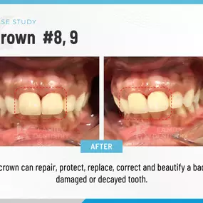 K Family Dentistry - General Cosmetic Emergency Implants Dentist in Pflugerville, TX 78660