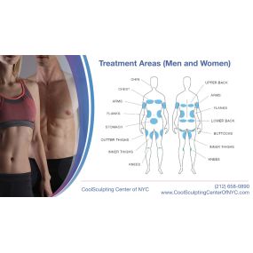 CoolSculpting Center of NYC: Fat Reduction Treatment Areas for Men and Women