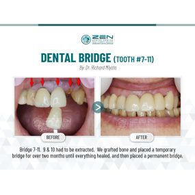 Zen Dental Center Family, Cosmetic, Implants -  Call: 206-324-1100 | Location: 310 Harvard Ave, Unit E Seattle, Washington 98102
