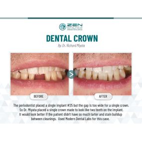 Zen Dental Center Family, Cosmetic, Implants -  Call: 206-324-1100 | Location: 310 Harvard Ave, Unit E Seattle, Washington 98102