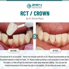 Zen Dental Center Family, Cosmetic, Implants -  Call: 206-324-1100 | Location: 310 Harvard Ave, Unit E Seattle, Washington 98102