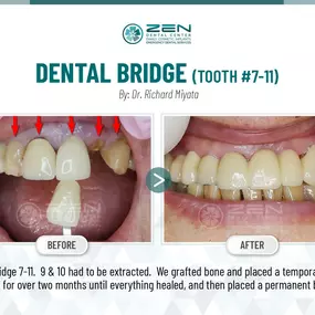 Zen Dental Center Family, Cosmetic, Implants -  Call: 206-324-1100 | Location: 310 Harvard Ave, Unit E Seattle, Washington 98102