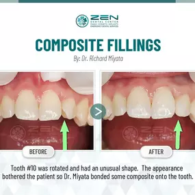 Zen Dental Center Family, Cosmetic, Implants -  Call: 206-324-1100 | Location: 310 Harvard Ave, Unit E Seattle, Washington 98102